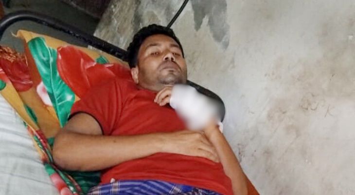 মোরেলগঞ্জে ছাত্রদল নেতাকে হাতুড়ি পেটা করে জখম করেছে দুর্বৃত্তরা