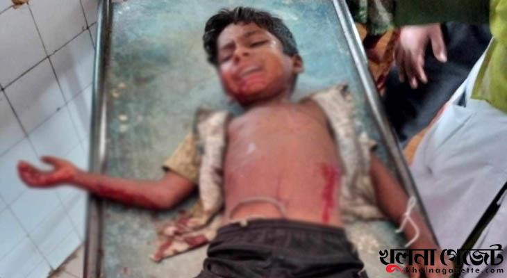 যশোরে কুড়িয়ে পাওয়া ককটেল বিস্ফোরণে তিন শিশু জখম