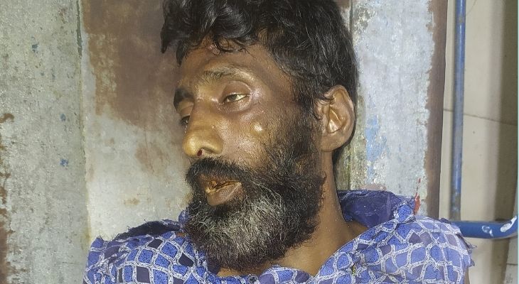 খুলনায় সড়ক দূর্ঘটনায় রিকশা চালকের মৃত্যু