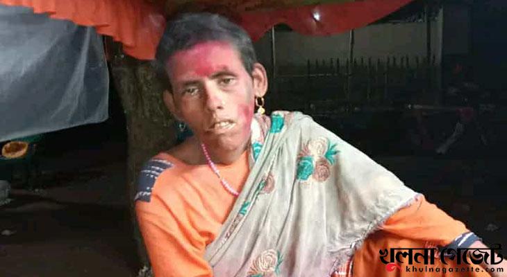 কয়রায় পুকুর থেকে মানসিক ভারসাম্যহীন নারীর মরদেহ উদ্ধার