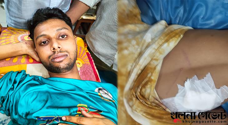 নগরীতে গুলিতে বিশ্ববিদ্যালয়ের ছাত্র আহত, ছুরিকাঘাতে যুবক জখম