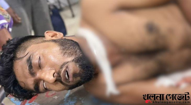 খুলনায় দুর্বৃত্তের ছুরিকাঘাতে যুবক আহত