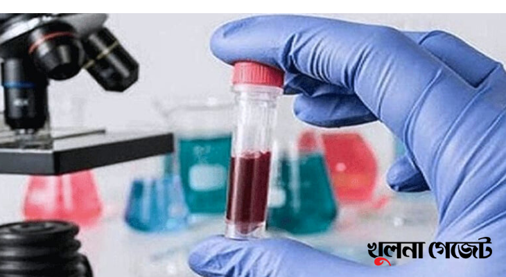 এবার কারাগারে শুরু ডোপ টেস্ট, শনাক্ত ৮