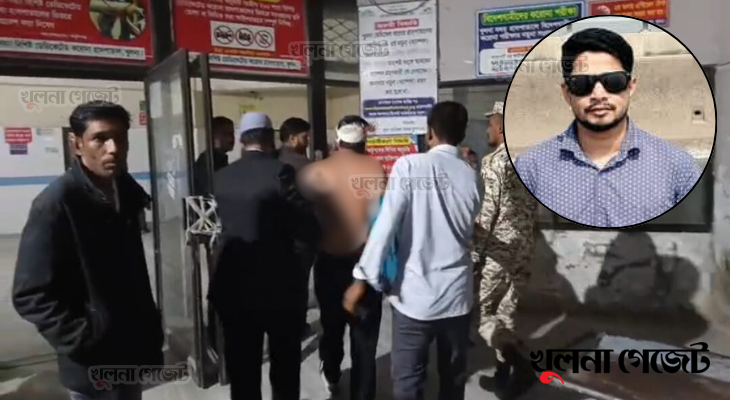 নগরীতে আবারও যুবককে হত্যার উদ্দেশ্যে গুলি