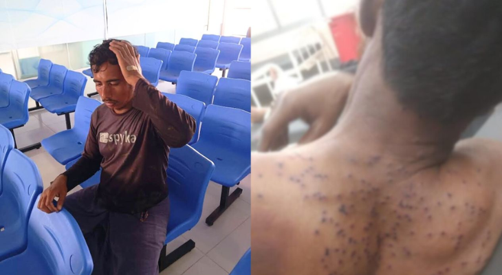 বঙ্গোপসাগরে ৩ ট্রলারে জলদস্যুদের হামলা, গুলিবিদ্ধসহ আহত ১১ মাঝি