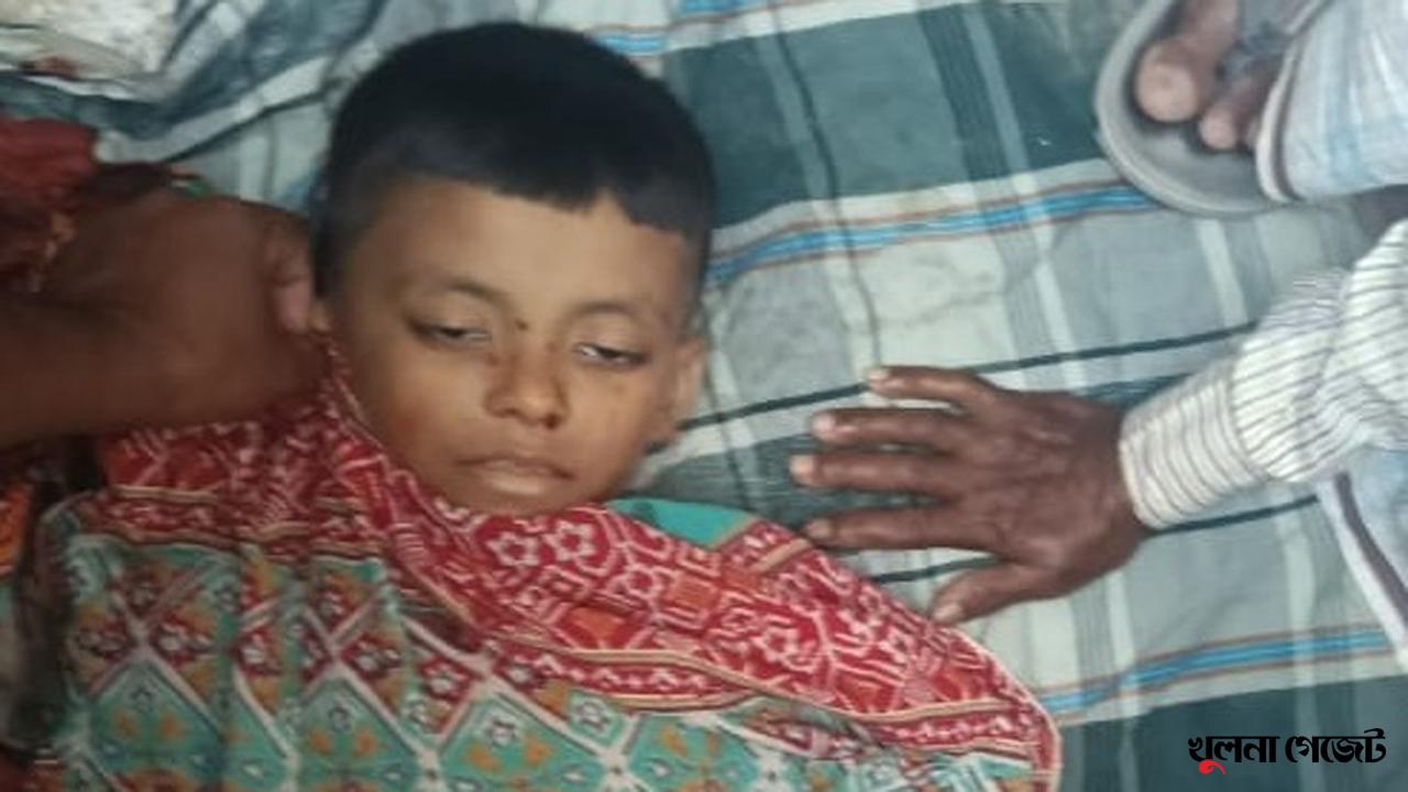 গোপালগঞ্জে ইজিবাইকের চাপায় শিশু নিহত