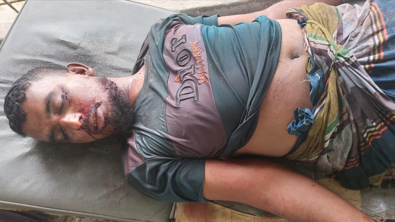 কয়রায় কোরবানির পশু বহনকারী নসিমন উল্টে ব্যবসায়ী নিহত, আহত ৩