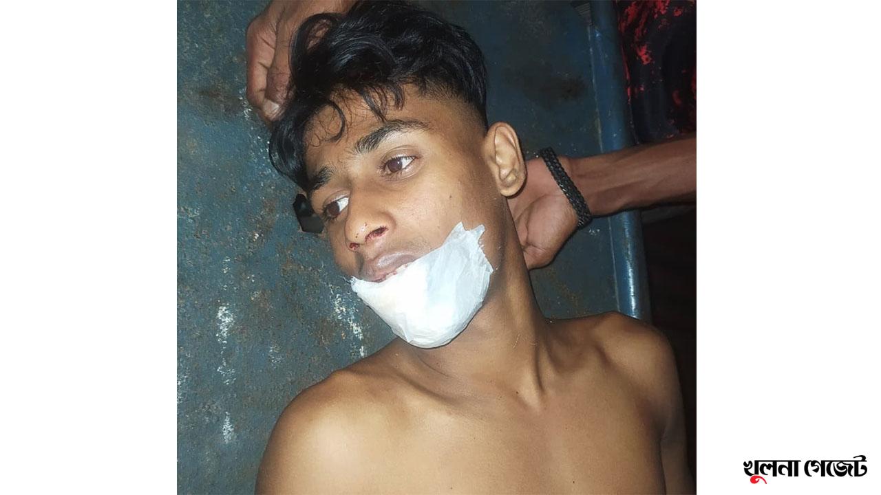 ছিনতাইকারীদের হাত থেকে মোবাইল রক্ষা করতে গিয়ে যুবক আহত