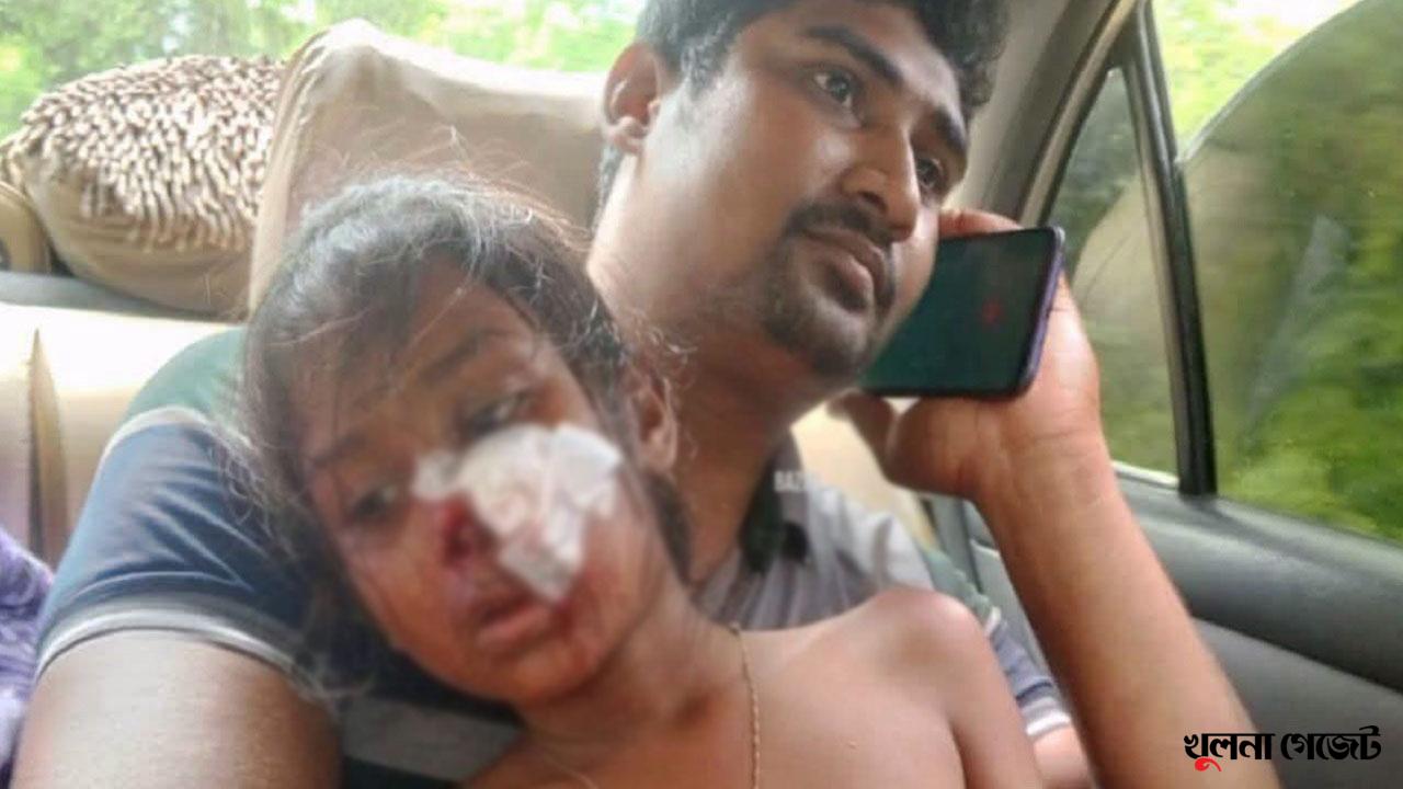 কপিলমুনিতে শ্রেণীকক্ষের ফ্যান খুলে পড়ে প্রথম শ্রেণীর শিক্ষার্থী আহত