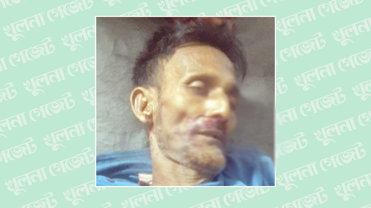 রূপসায় ছেলে হত্যার ৫০ দিন পর গুলিতে বাবা নিহত