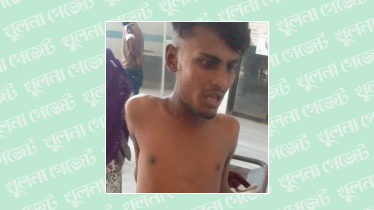 খুলনায় দুর্বৃত্তের গুলিতে যুবক আহত